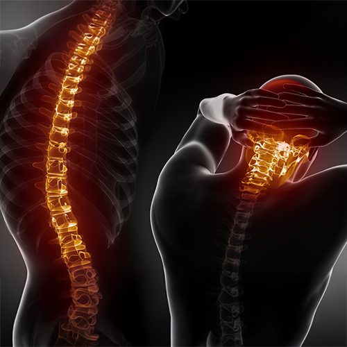 Photo: Joint Replacement